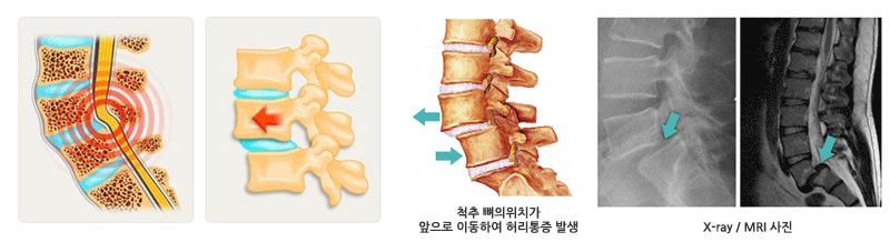 x-ray/MRI����