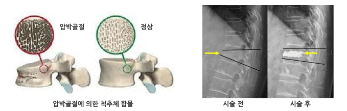 �ü� ���� �񱳻���