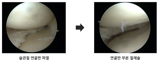 ������, ������ �κ� ������