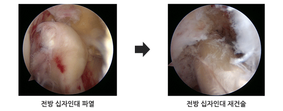 ������, ���� �����δ� ��Ǽ�