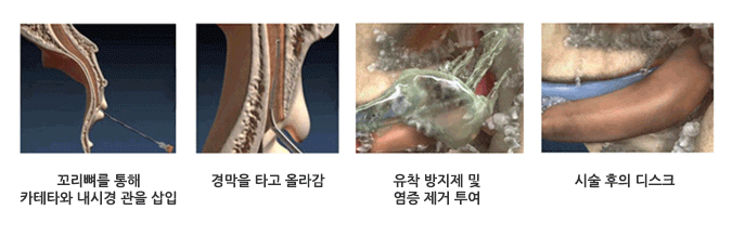 �������� ���� ī��Ÿ�� ���ð� ���� ���� - �渷�� Ÿ�� �ö� - ���� ������ �� ���� ���� ���� - �ü� ���� ��ũ